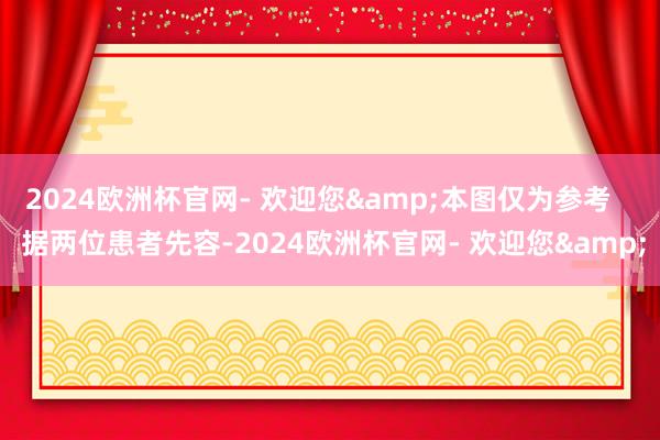 2024欧洲杯官网- 欢迎您&本图仅为参考    据两位患者先容-2024欧洲杯官网- 欢迎您&